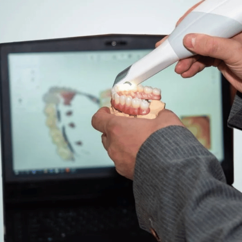 Treatment - Priory Dental